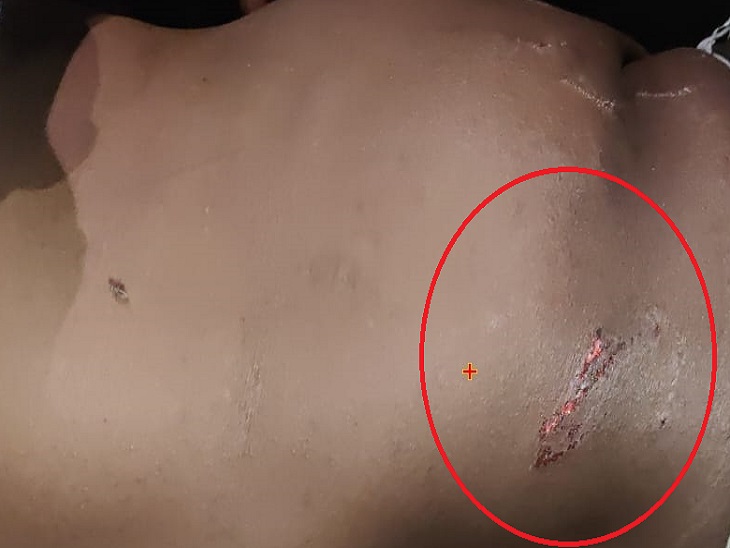 लेपर्ड ने पूजा कर रहे 2 लोगों पर किया हमला:  झाड़ियों से निकलकर आया; चीखें सुनकर ग्रामीण पहुंचे तो जंगल की ओर भाग गया – Udaipur News
