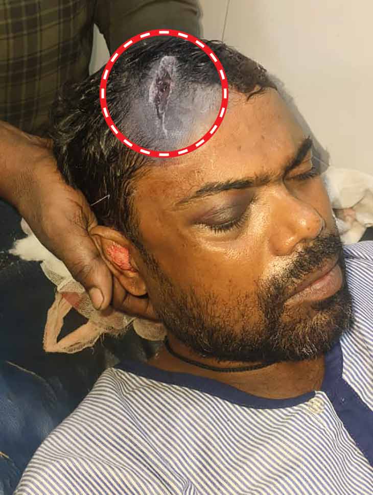 हनुमान के सिर में धारदार हथियार से वार करने का घाव था। लखनऊ में 16 दिन इलाज चला, 20 अक्टूबर को हनुमान ने हॉस्पिटल में दम तोड़ दिया।