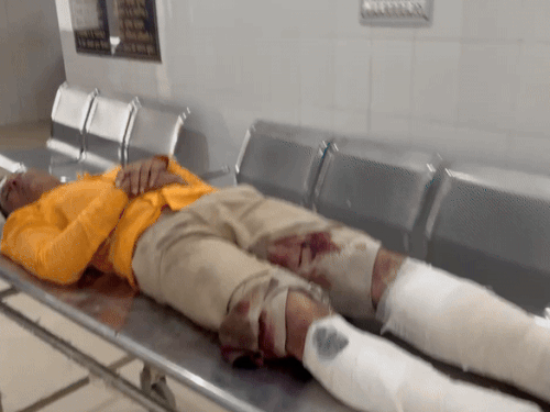 मारपीट में युवक के हाथ पैर टूट गए।