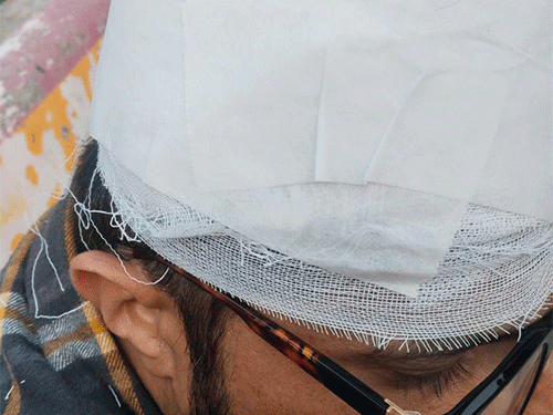 हादसे में स्विफ्ट सवार युवक सहित दाे लाेग घायल हाे गए।