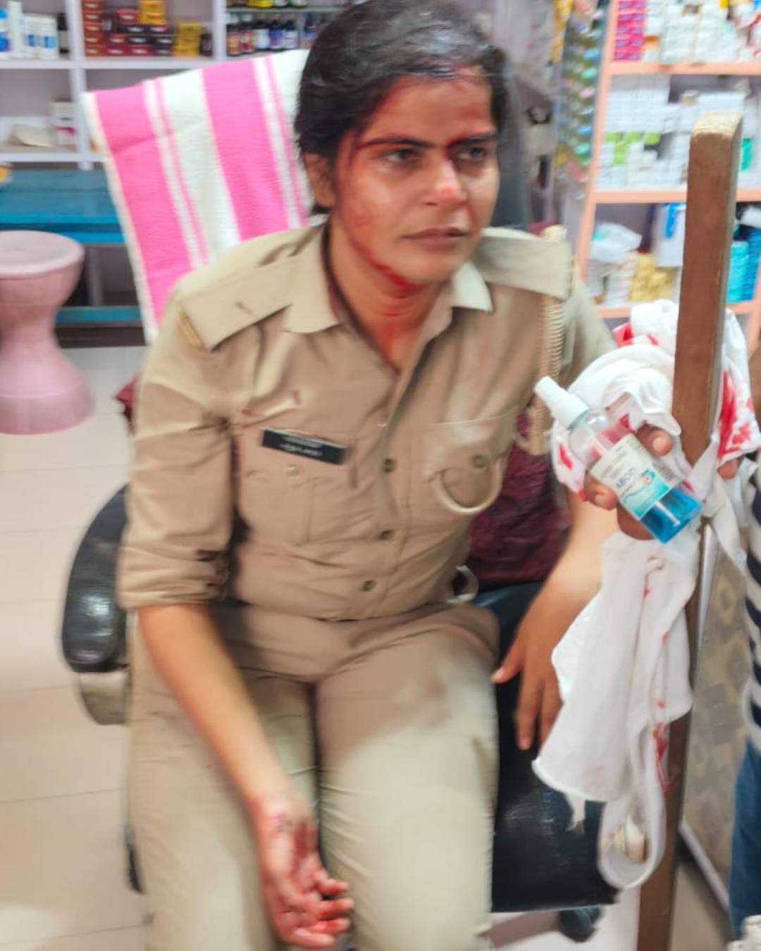 पथराव में घायल महिला पुलिसकर्मी