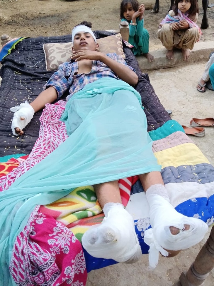 पलवल में करंट से झुलसा 8वीं कक्षा का छात्र:  स्कूल हैड मास्टर ने बिजली तार जोड़ने चढ़ाया; हाथ-पांव की उंगलिया खत्म, दो पर FIR – Palwal News