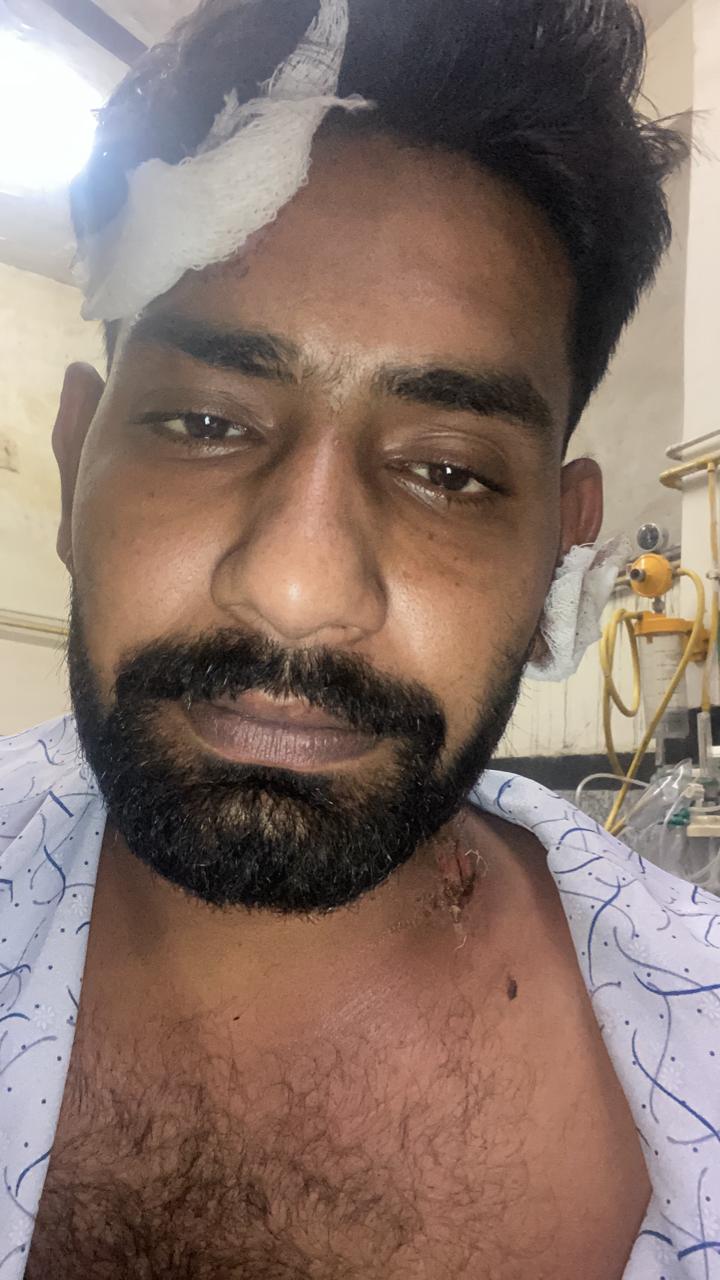 पंचकूला नाइट फूड स्ट्रीट में चले चाकू-रॉड:  सिगरेट पी रहे 3 युवकों को आई चोटें; पुरानी कहासुनी को लेकर हुआ झगड़ा – Panchkula News