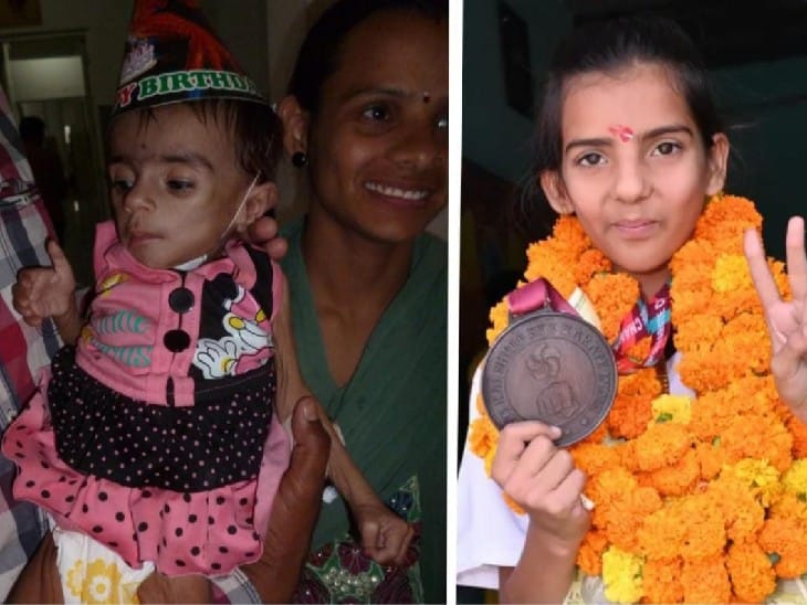 दीक्षिता इलाज से पहले और अब इस तरह से नजर आ रही हैं।