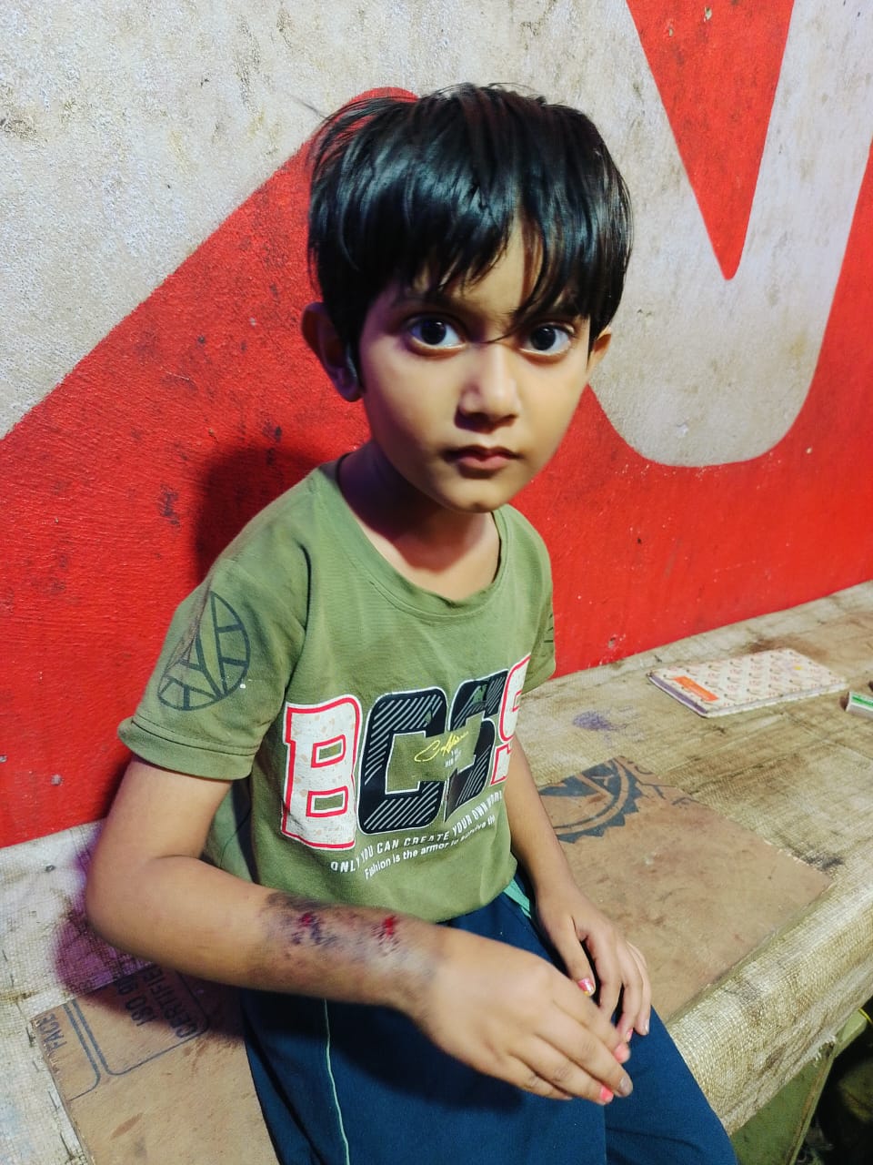 कुत्ते के हमले में घायल परी नागर।