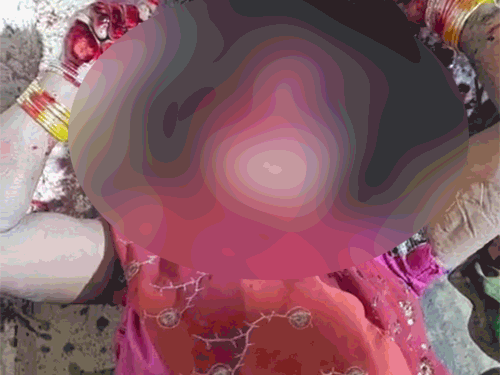 दादी के सिर पर कई वार के निशान थे।