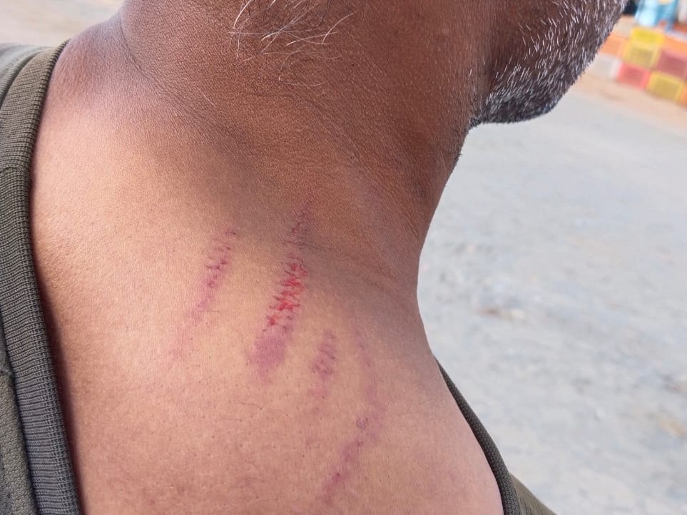 मारपीट में व्यापारी के गले में चोट भी पहुंची।