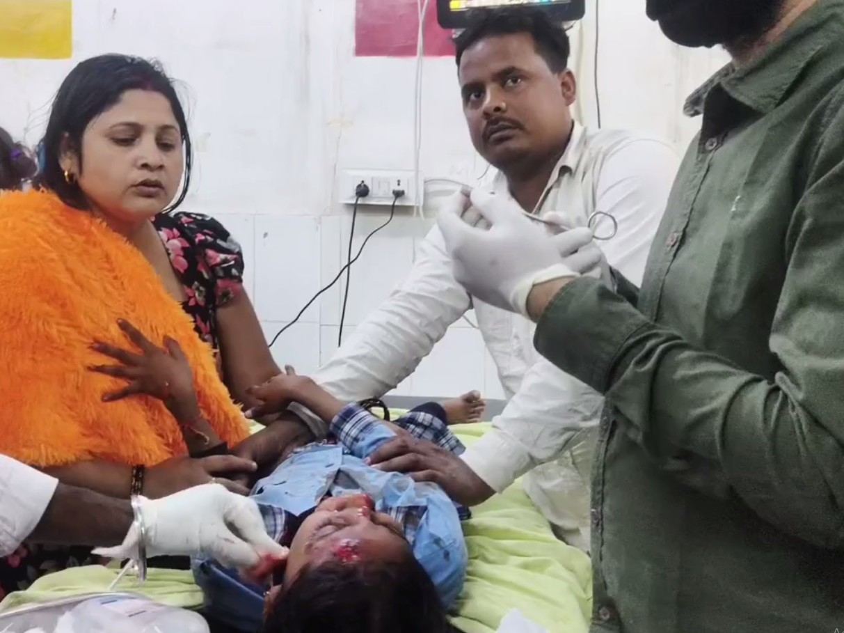 खन्ना में एक्टिवा की टक्कर से 3 बच्चे घायल:  नाबालिग छात्र चला रहा था, छुट्टी के बाद स्कूल से जा रहा था घर – Khanna News