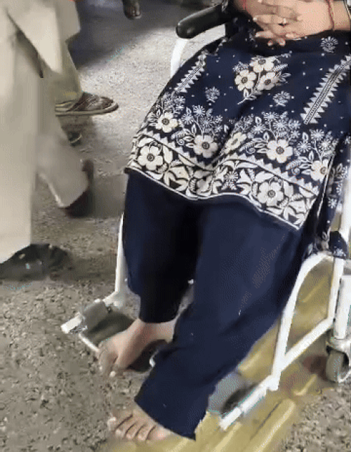 अस्पताल में इलाज के लिए पहुंची छात्रा अंजलि के भी पैर में चोट है।