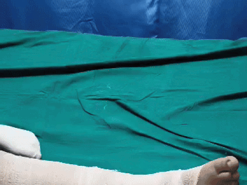 यमुनानगर सिविल अस्पताल में भर्ती स्टूडेंट अर्चिता। उसके पैर में फ्रैक्चर हुआ है।