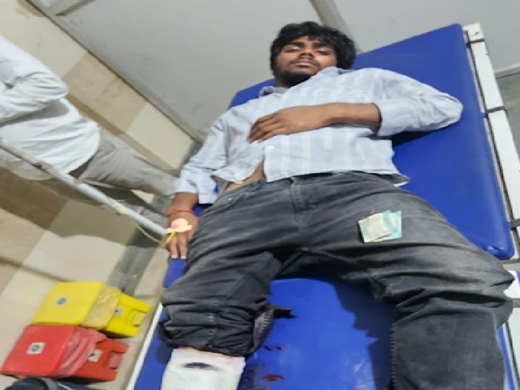 पुलिस मुठभेड़ में घायल हुआ आरोपी।