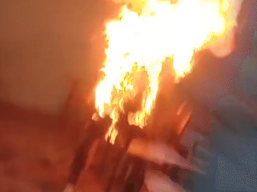 छात्र 70 फीसदी जल गया है। उसको मेरठ रेफर कर दिया है। - Dainik Bhaskar