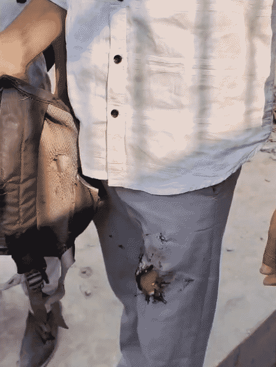 उज्ज्वल को बचाने में उसके एक साथी का बैग और पैंट जल गई।