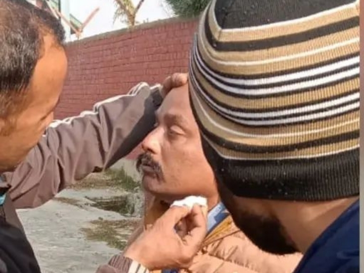लोकोमोटिव पायलट घायल हो गया।