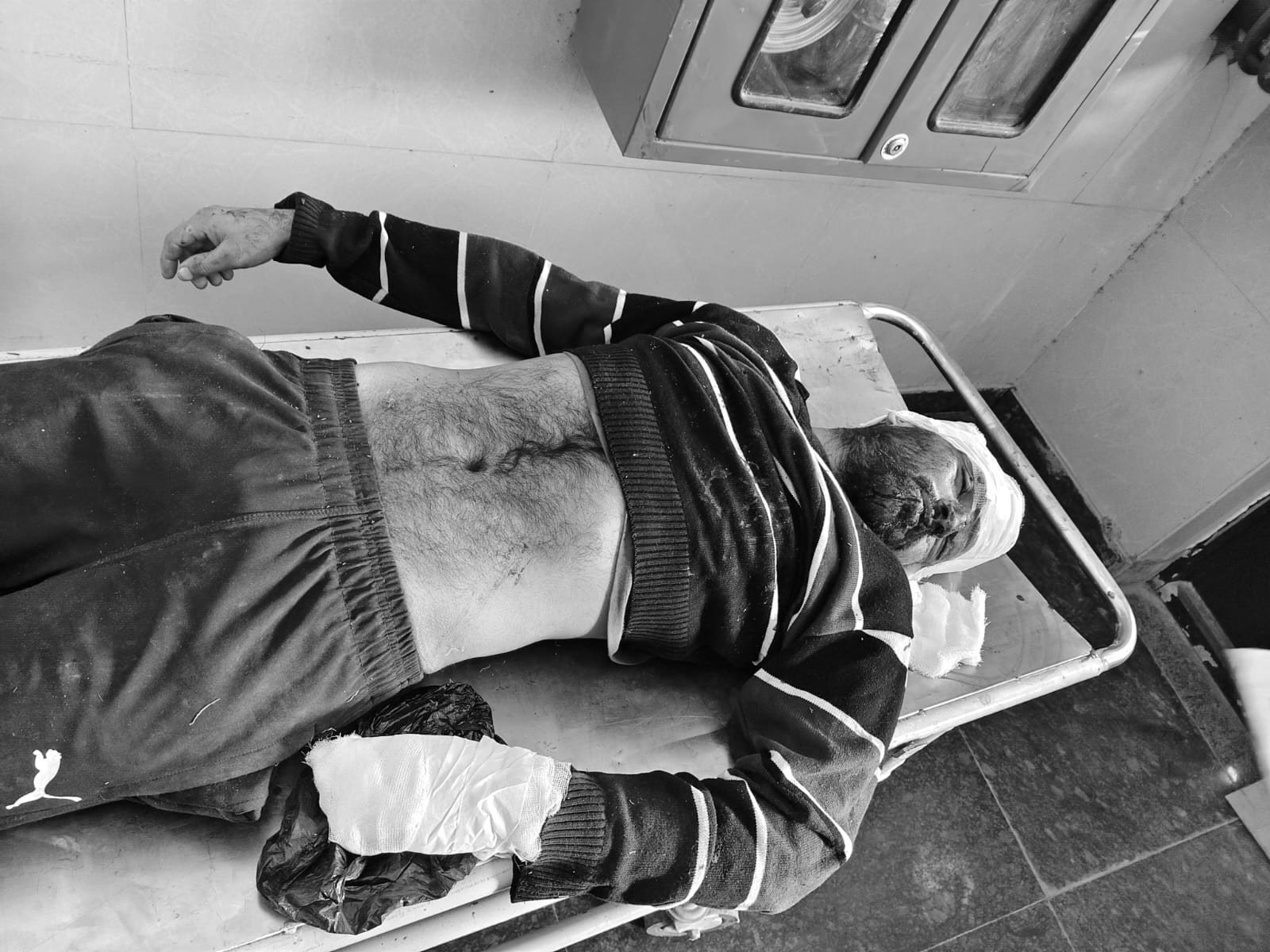 उचाना-हांसी मार्ग पर कार-बाइक की टक्कर:  35 साल के व्यक्ति की मौत, दूसरा गंभीर घायल; ड्राइवर पर केस दर्ज – Uchana News