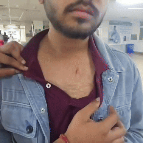 छाती पर लगे नाखुन के निशान दिखाता हुआ अर्जुन।