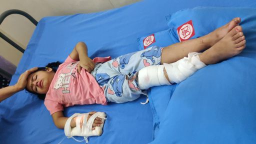 ब्यूटी पार्लर में युवती के पैर में लगी गोली:  दर्द होने पर पता चला, गोली कहां से आई नहीं पता, पुलिस जांच में जुटी – Chandigarh News