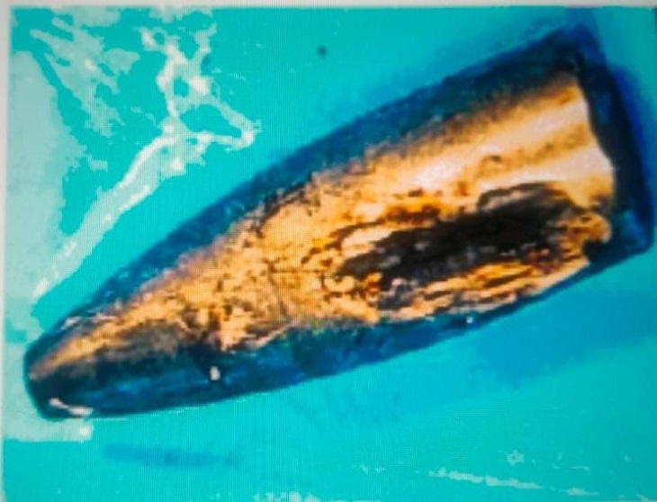 पैर में लगी गोली का खोल।