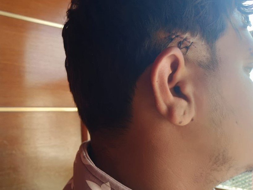 युवक के कान पर चोट आई है।