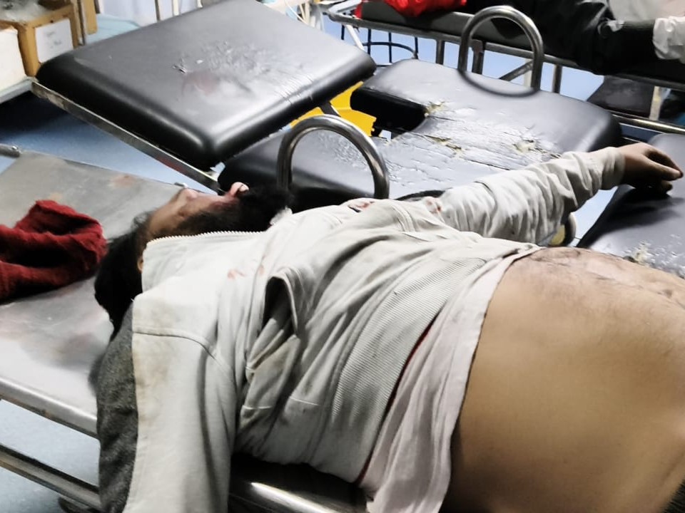 कपूरथला में बस और बाइक की टक्कर:  पिता-पुत्र की मौके पर मौत, प्लास्टर कटवाने के लिए लेकर जा रहा था बेटा – Kapurthala News