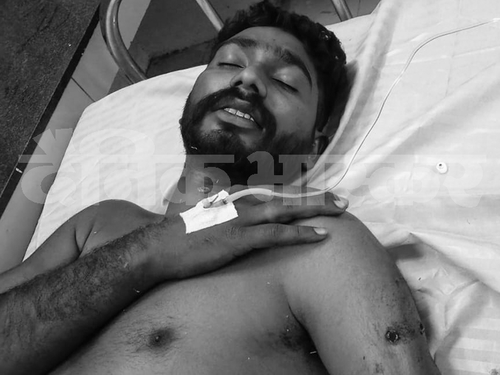 दूसरे आतंकी का भी अस्पताल में इलाज चल रहा है, इसे हाथ में गोली लगी है।