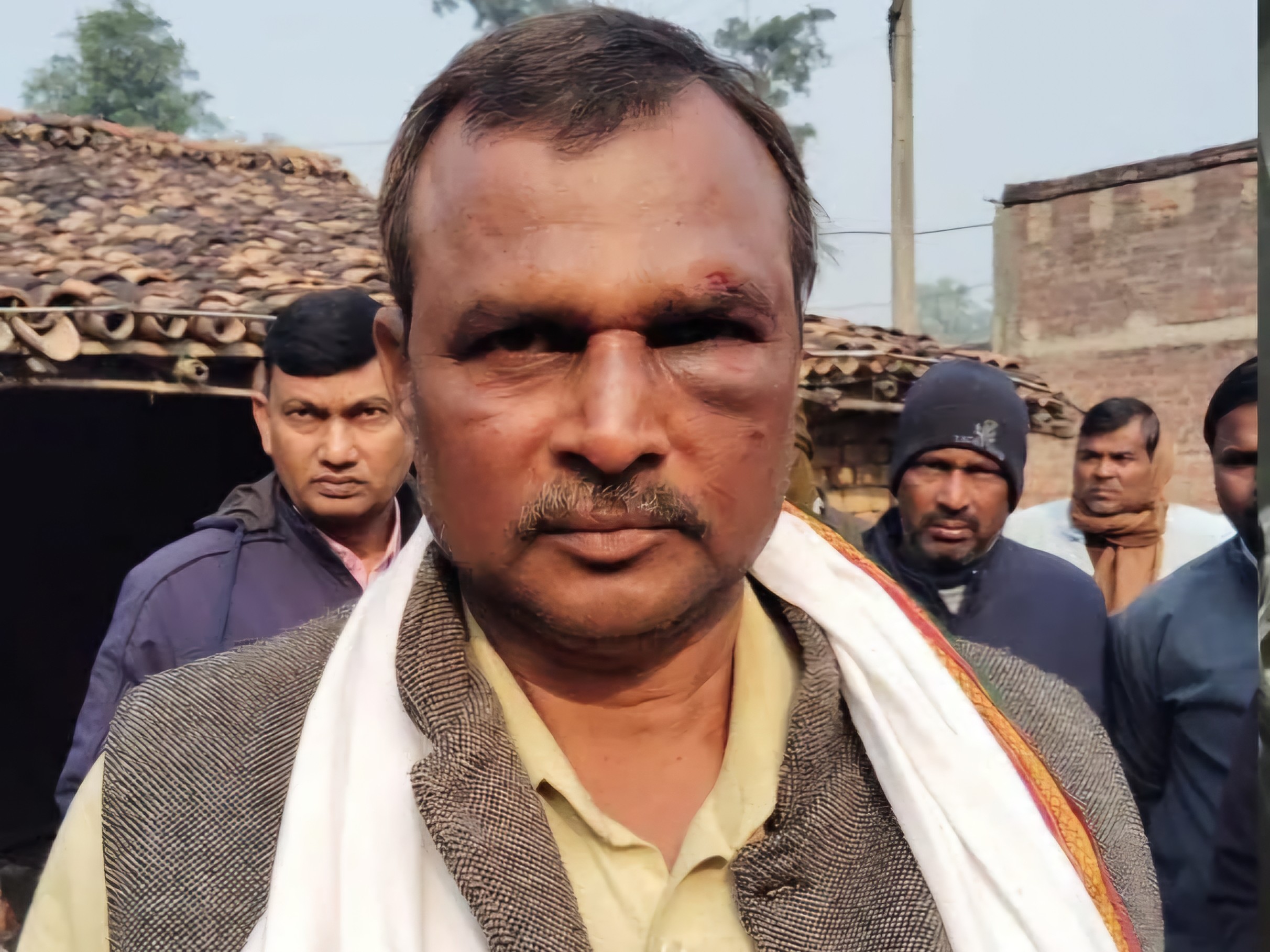 पलामू में शिक्षक दंपती के घर डकैती:  हथियारबंद बदमाशों ने 4 घंटे बंधक बनाकर लूटा, खाना बनवा खाया भी; सुबह हुए फरार – Palamu News