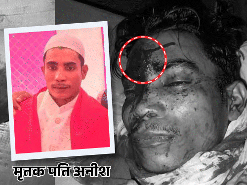 In Basti, the wife got her husband murdered by her lover. | यूपी में शादी के 7वें दिन पति की हत्या कराई: चौथी में मायके गई तो साजिश रची, प्रेमी ने माथे