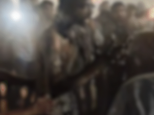 आग बुझने के बाद झुलसी हालत में युवक।