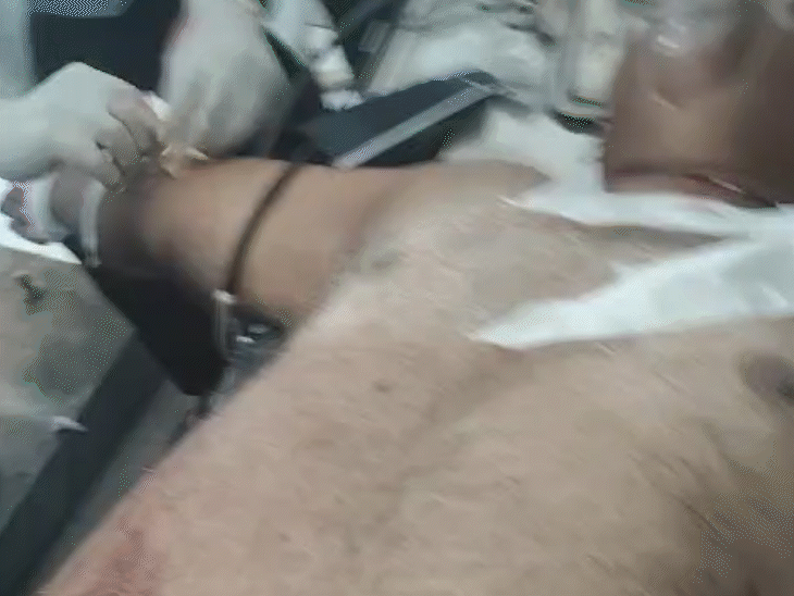 दिलीप कुमार को बेहतर इलाज के लिए खगड़िया से बेगूसराय रेफर किया गया है।