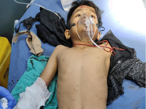 हादसे में एक बच्चे समेत चार लोग घायल हो गए।