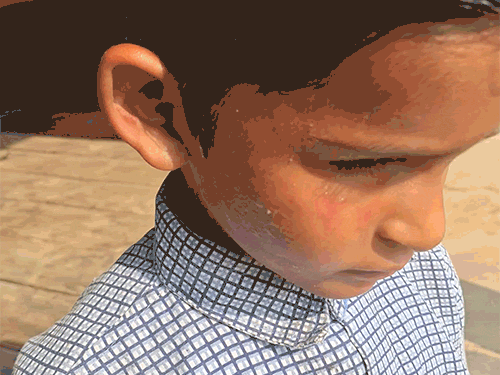 टीचर ने दूसरी कक्षा के 7 साल के स्टूडेंट को इतना जोर से थप्पड़ मारा कि दोनों चेहरा सूज गया।