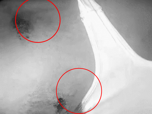 व्यक्ति के कंधे पर 2 गोलियां लगी हैं। उसका इलाज अस्पताल में चल रहा है। - Dainik Bhaskar