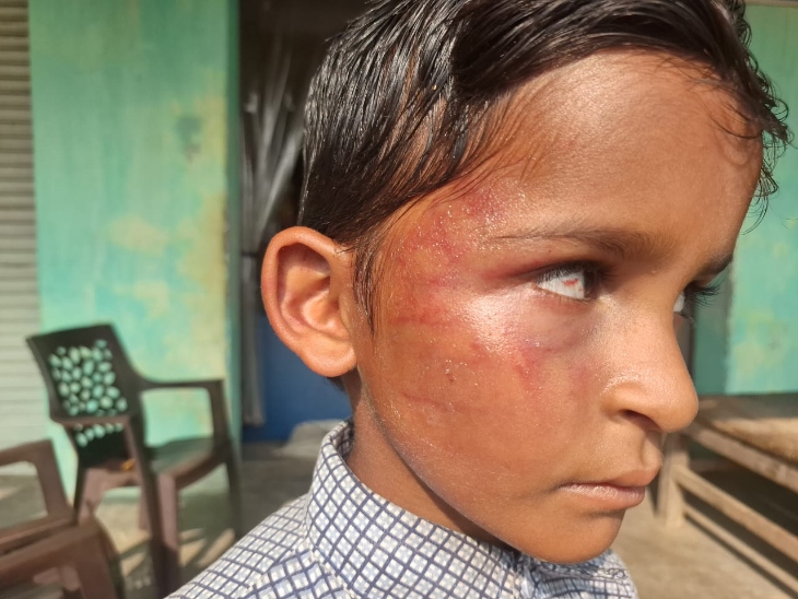 बच्चे ने रोते हुए परिजनों को बच्चों बताई आपबीती। परिजनों ने पुलिस में शिकायत दर्ज कराई है।