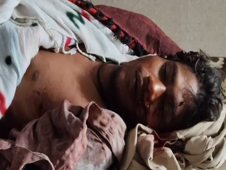 मृतक के चेहरे सीने में चाकू के निशान थे।