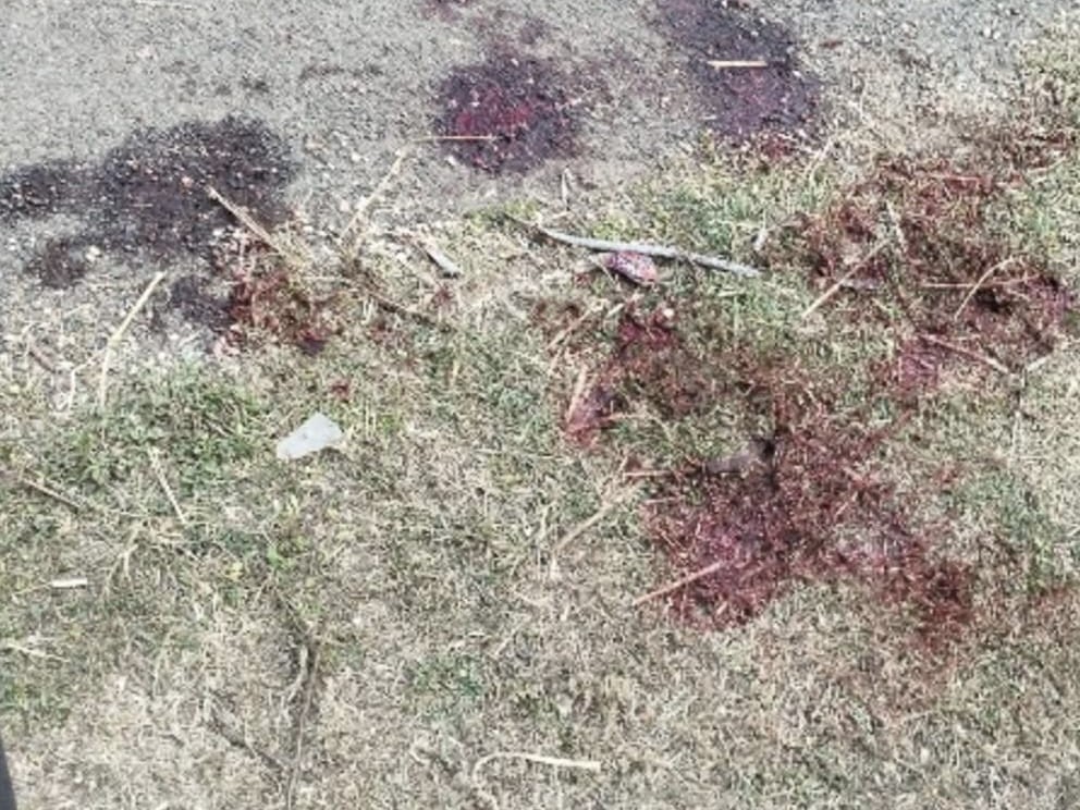 गोली लगने के बाद मौके पर खून फैल गया।