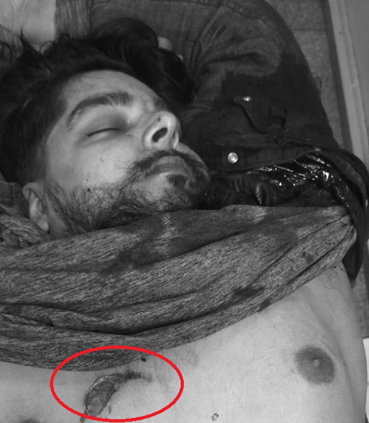 इंद्रप्रीत पैरी की छाती में दिख रहा गोली का निशान, इसी से उसकी मौत होने की संभावना जताई जा रही है।