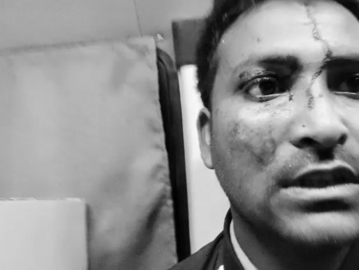 हादसे में कई घायल बुरी झुलस गए। वे दर्द से कराह रहे थे। उन्हें नजदीकी अस्पताल पहुंचाया गया।