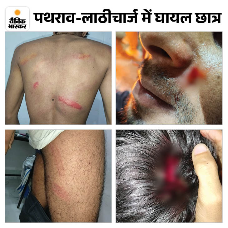 Proctoral Ruckus between the Proctorial Board and students at BHU