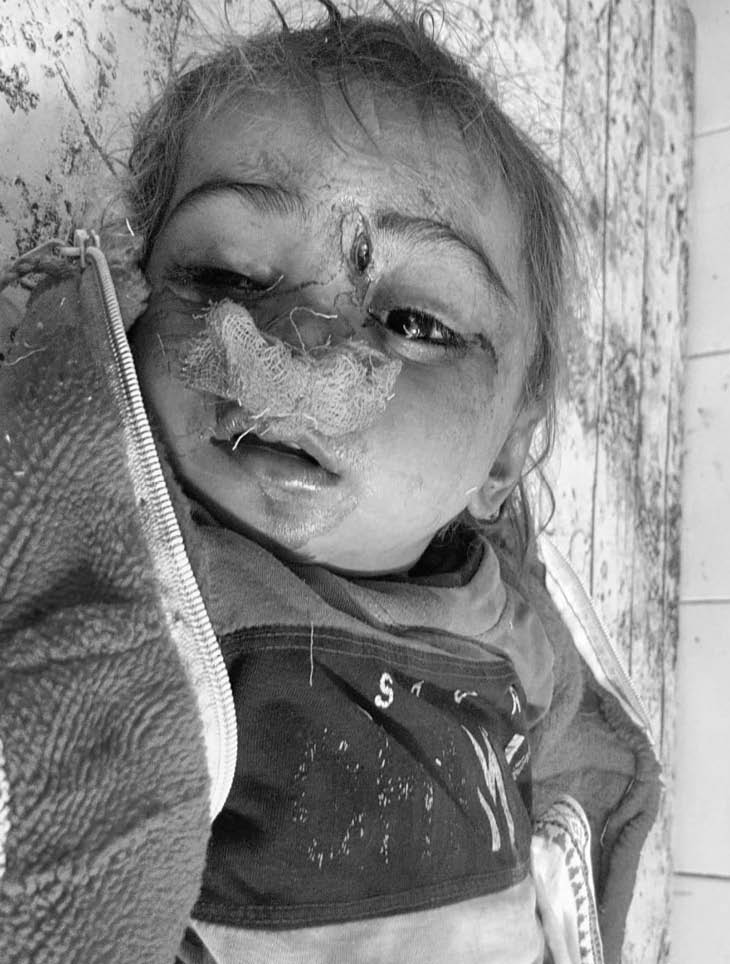 हादसे में बच्ची की मौके पर ही मौत हो गई।