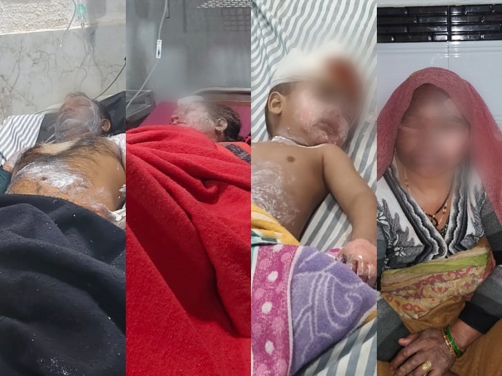 सिलेंडर ब्लास्ट में जितेंद्र, आरती, हर्ष और गुड्डी देवी झुलस गए।