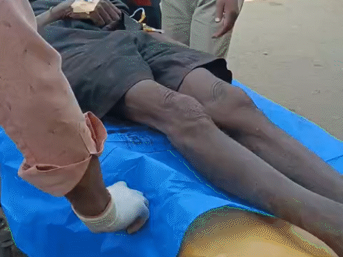 डॉक्टरों के मुताबिक, सांस नली कटने से किसान की हालत गंभीर है।