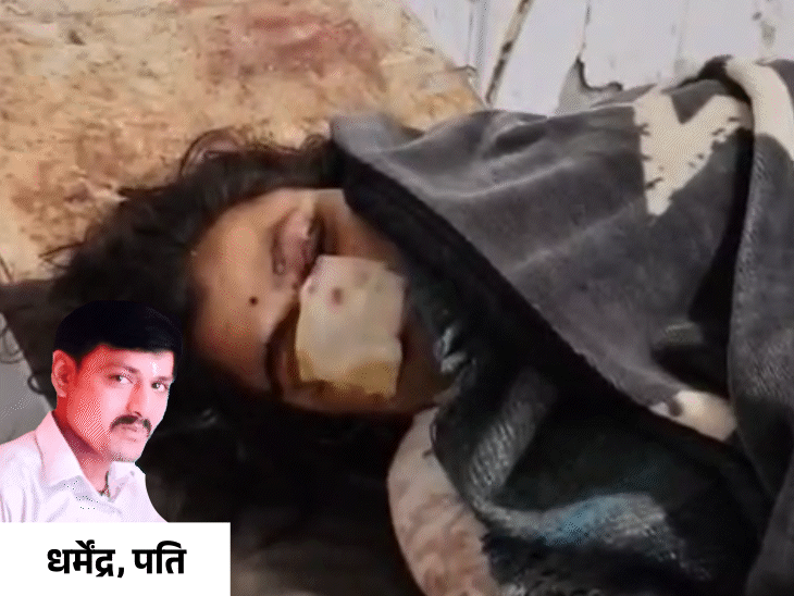 पत्नी की नाक काटकर आरोपी पति धर्मेंद्र फरार हो गया। - Dainik Bhaskar