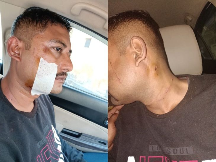 ASI प्रशांत कुमार प्रकाश के सिर, गले और हाथ में चोटें आई हैं।