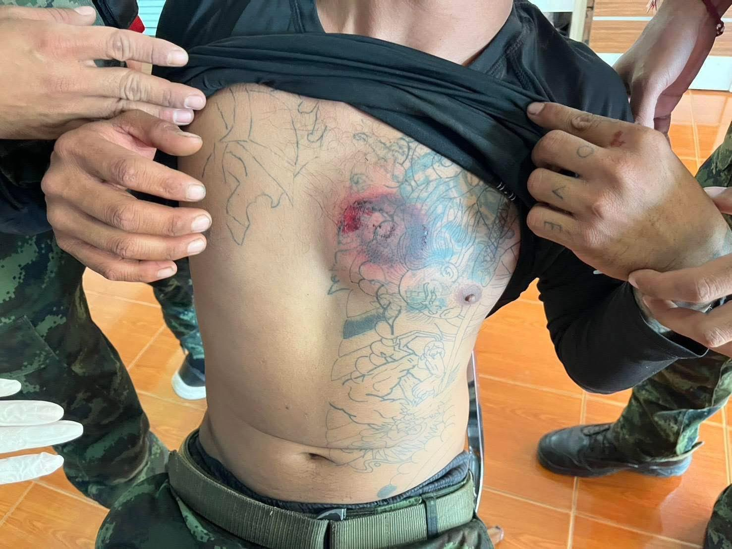 कंबोडियाई सैनिकों के हमले में एक थाई सैनिक को सीने पर गोली लगी। चेस्ट आर्मर की वजह से गोली शरीर के अंदर नहीं घुस पाई।