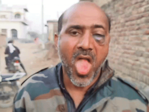 हमले में गांव के एक व्यक्ति को भी आई चोट।