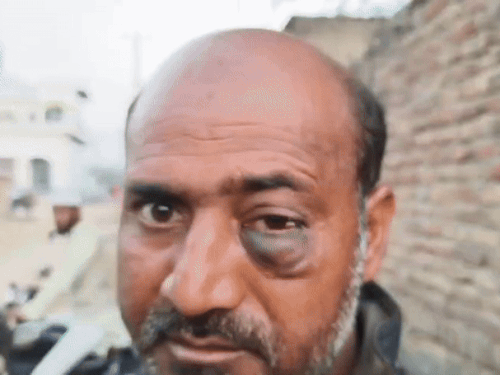 इस हमले में गांव के एक व्यक्ति को भी आई चोट।