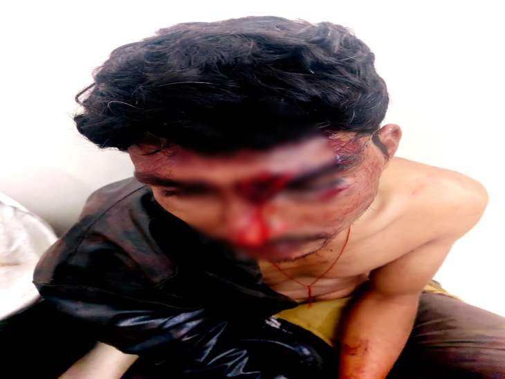 पिटाई में युवक को गंभीर चोटें आई हैं। चेहरे और शरीर के अन्य जगहों से खून निकल रहा है।