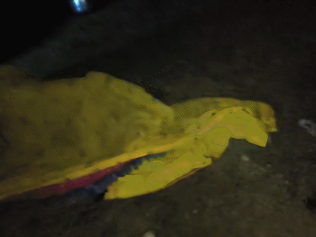 डॉक्टर्स के अनुसार दोनों को जब हॉस्पिटल लाया तो पूरा शरीर कोयले जैसा हो गया था।