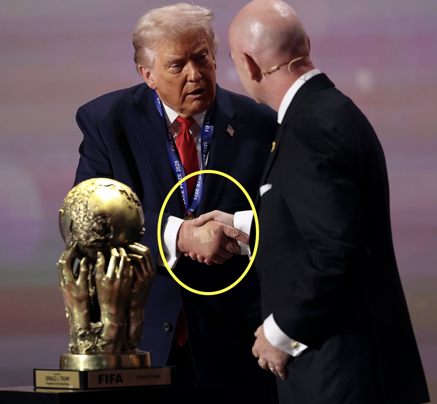 राष्ट्रपति डोनाल्ड ट्रम्प को फीफा शांति पुरस्कार से सम्मानित किया गया। इस दौरान उनके हाथ पर बैंडेज दिखा था।