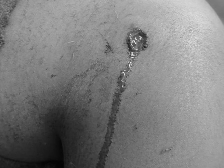 पहली गोली युवती के कंधे में लगी।